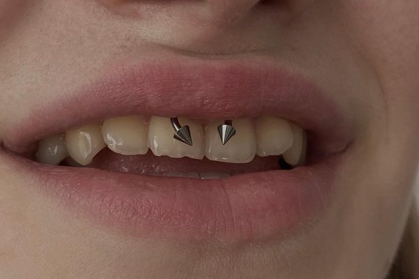 382539883_698437445649762_7657420535106385810_n