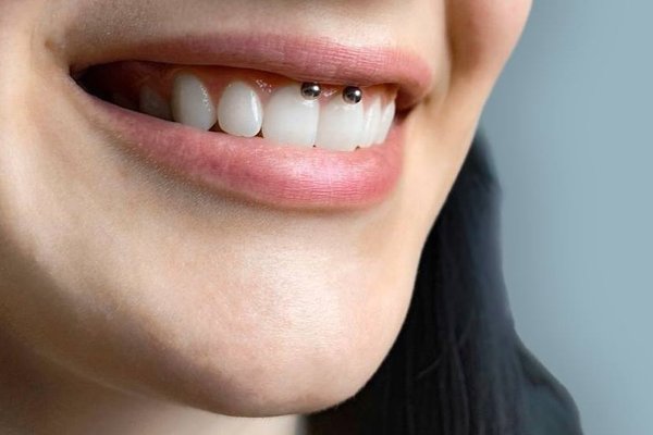 431249350_327236347000974_8601472978053822518_n