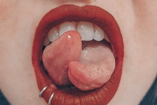 tumblr_8835eab38fd79e33648c803c6bbe8f7b_564ebd1c_1280